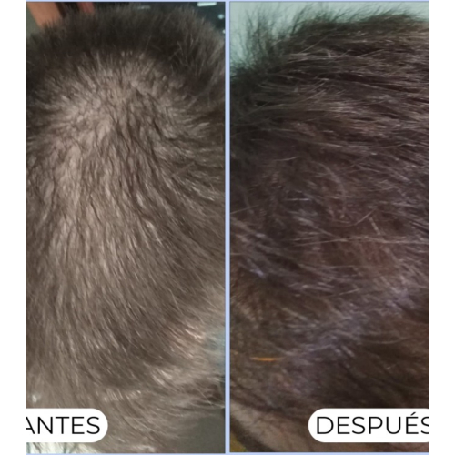 Alma Secret - Shampooing purifiant Shikakai pour cheveux normaux ou gras