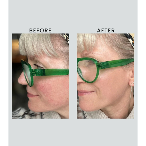 Altruist - Crème de jour Dermatologist Anti-Redness & Pigmentation Light SPF50