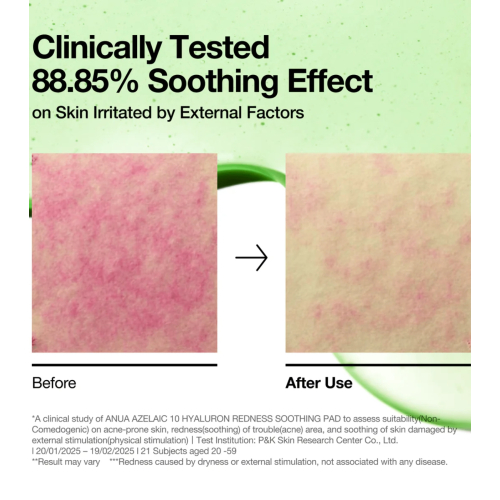 Anua - Tampons Azelaic 10 Hyaluron Redness Soothing format de tampons