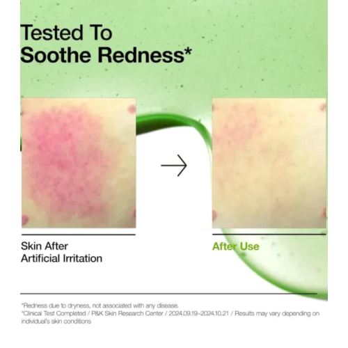 Anua - Sérum anti-acné avec 10+ acide azélaïque et acide hyaluronique