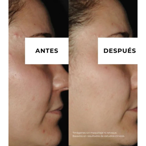 Arganour - Crème anti-acné anti-taches  Equilibrium - Peau grasse à tendance acnéique