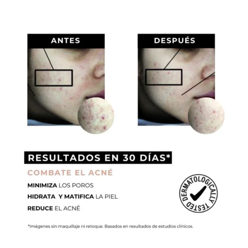 Arganour - Crème anti-acné anti-taches  Equilibrium - Peau grasse à tendance acnéique