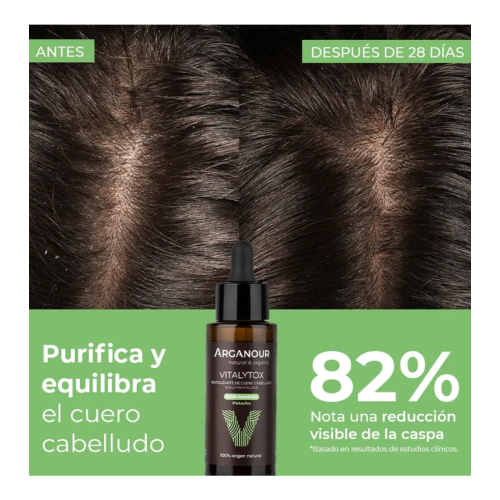 Arganour - Soin revitalisant du cuir chevelu Vitalytox