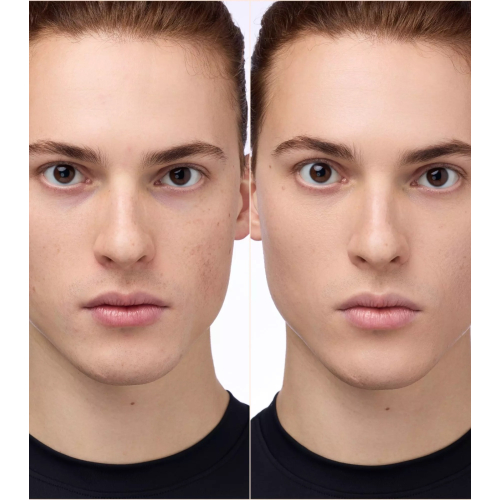 Catrice - Anti-cernes Instant Bright - 032N