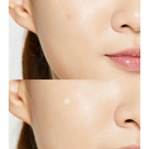 COSRX - Patchs d'imperfections Acne Pimple Master Patch