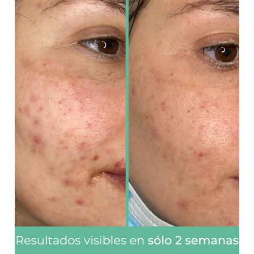 CR Cosmetics - *Purifying* - Crème visage séborégulatrice