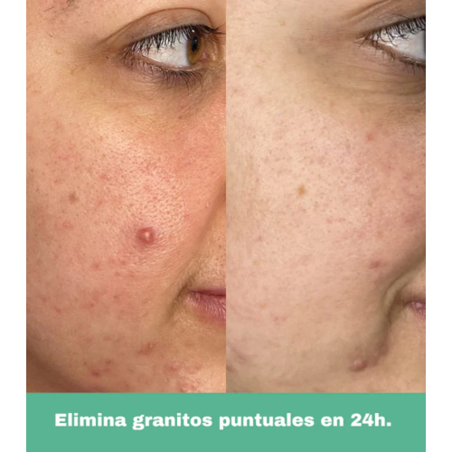 CR Cosmetics - *Purifying* - Roll-on anti-imperfections