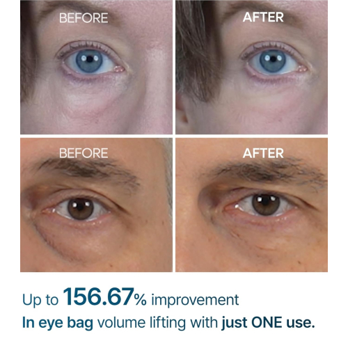 Dr.Melaxin - Crème anti-cernes Eyephalt