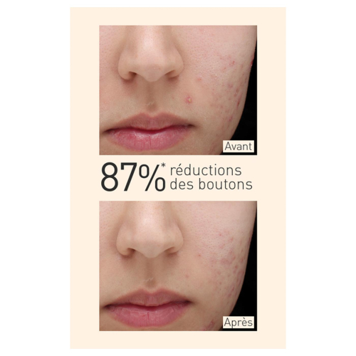 Embryolisse - Sérum matifiant pour peaux mixtes à grasses à l'extrait de Curcuma