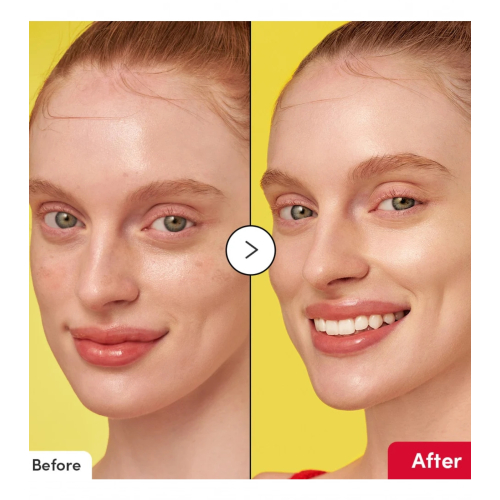 Eqqualberry - Sérum visage éclaircissant Vitamin