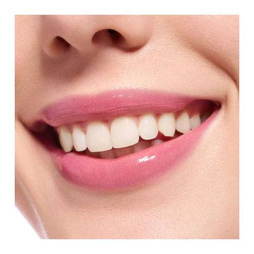 essence - Gloss à lèvres volumisant Extreme Shine - 21: Pretty in Pink