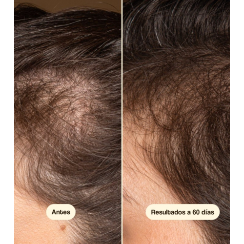 Freshly Cosmetics - Traitement anti-chute Hair Growth & Density