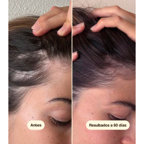 Freshly Cosmetics - Traitement anti-chute Hair Growth & Density