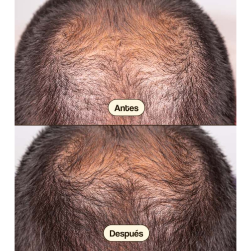 Freshly Cosmetics - Traitement anti-chute Hair Growth & Density