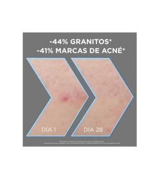 Garnier - *Skin Active* - Sérum anti-imperfections au Niacinamide, AHA, BHA et Charbon