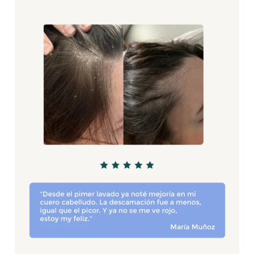 Green Cornerss - Shampoing aux pois - Cuir chevelu sensible