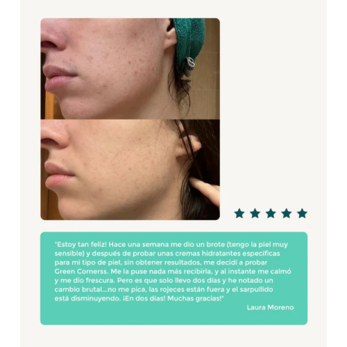 Green Cornerss - Crème hydratante visage au chou - Peau atopique