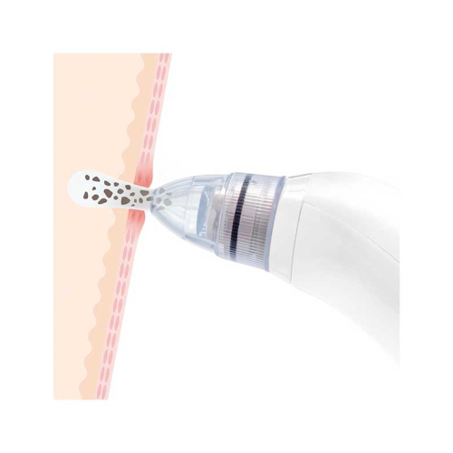 InnovaGoods - Nettoyant facial électrique pour les points noirs Pore·Off