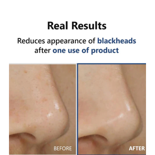 ISNtree - *Mugwort* - Sérum tonifiant du soir Hyper Acid 4 AHA BHA PHA LHA 30