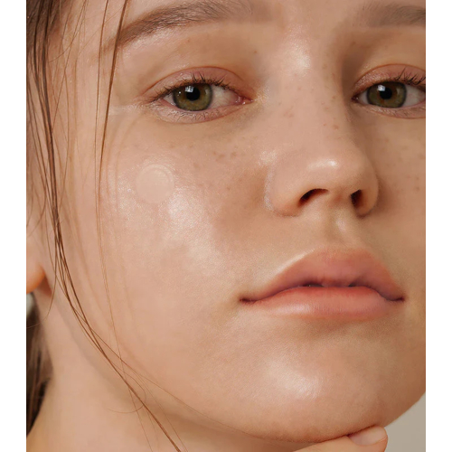 ISNtree - Patchs anti-imperfections Onion Newpair Basic - 24 unités