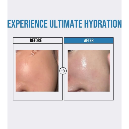 Jumiso - *Waterfull* - Sérum visage hydratant Hyaluronic Acid