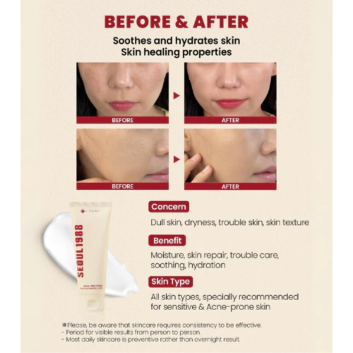 K-Secret - *Seoul 1988* - Crème visage Snail Mucin 93% + Rice