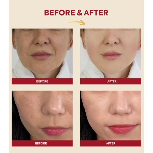 K-Secret - *Seoul 1988* - Essence Snail Mucin 97% + Rice