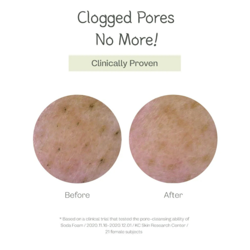 ma:nyo - Nettoyant visage Deep Pore Cleansing Soda Foam