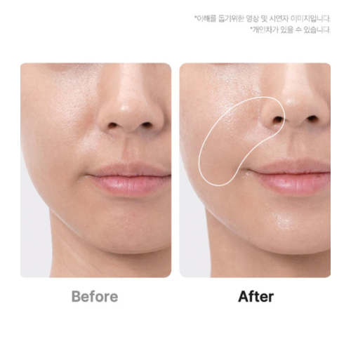 Medicube - *Age-R* - Appareil avancé de soins du visage Booster Pro Ex - Pink