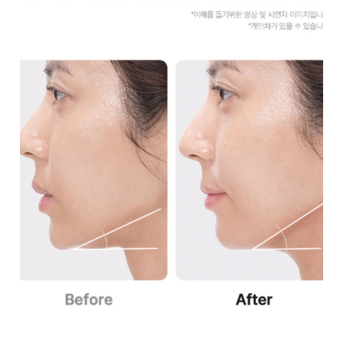 Medicube - *Age-R* - Appareil avancé de soins du visage Booster Pro Ex - Pink