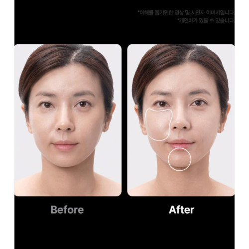 Medicube - *Age-R* - Appareil avancé de soins du visage Booster Pro Ex - Pink