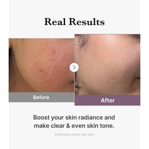 Medicube - *Age-R* - Tonique hydratant Glutathione Glow Toner