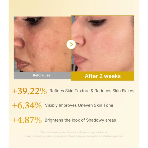 Medicube - *Kojic Acid* - Tonique facial exfoliant