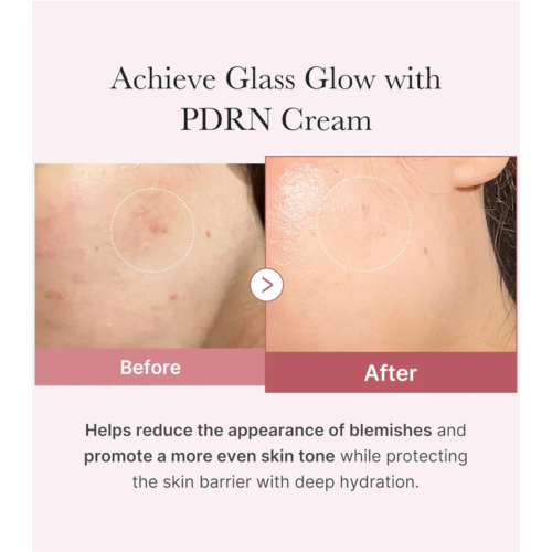 Medicube - *PDRN Pink* - Crème hydratante pour le visage Hyaluronic Moisturizing