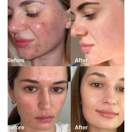 Medicube - *Red* - Sérum Red Succinic Acid Clarifying