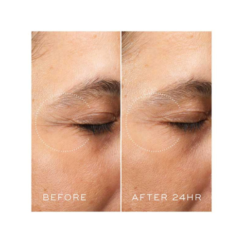 Medik8 - *Crystal Retinal* - Crème contour des yeux anti-âge au Retinal et à la Vitamine A Ceramide Eye 6