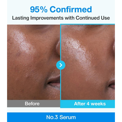 Numbuzin - Sérum minimisant les pores No.3 Blue Bio-Retinol