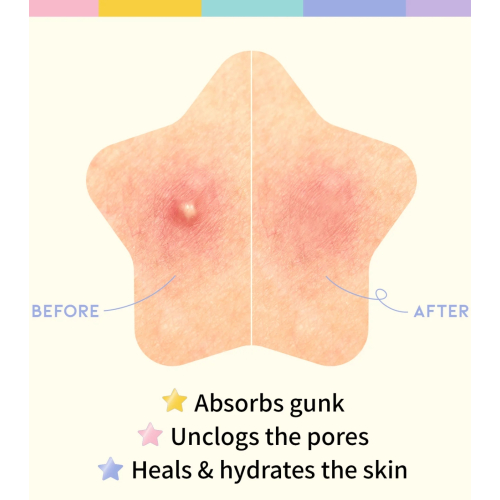 OOTD Beauty - Patch anti-taches étoilées Star Spot Patch