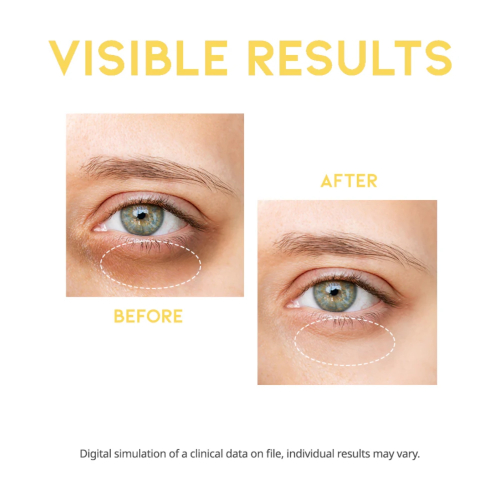 OOTD Beauty - Sérum illuminateur pour les yeux Dark Circle