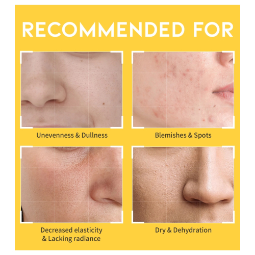 OOTD Beauty - Dark Spot Vitamin C Tonique illuminateur