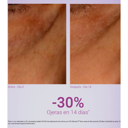 Primaderm - Contour des yeux anti-rides Xpert Expression Contour
