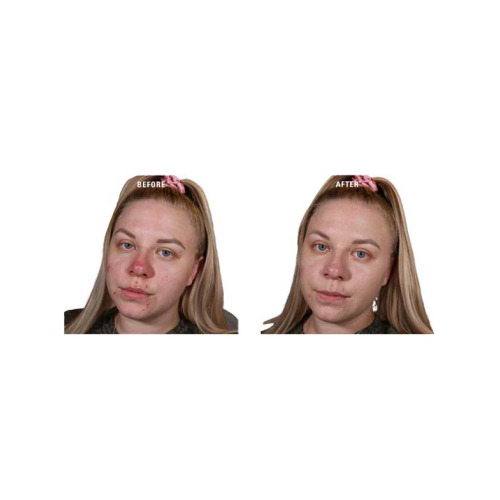 Revolution - Base de couleur crème Superbase Colour Correcting - Green