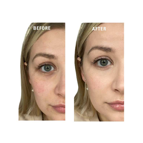 Revolution - Apprêt couleur crème Superbase Colour Correcting - Yellow