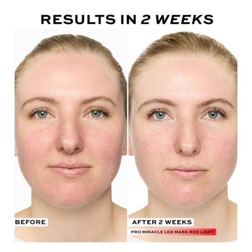 Revolution Pro - Masque facial Miracle LED Face Mask