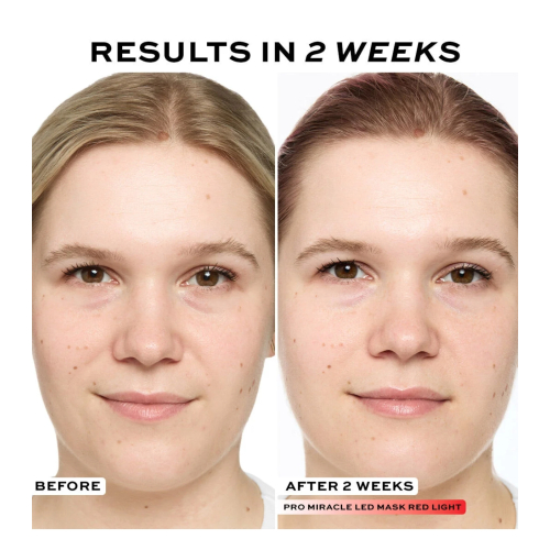 Revolution Pro - Masque facial Miracle LED Face Mask