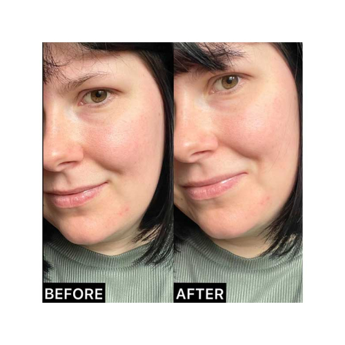 Revolution Pro - Stick Primer Blur Instant Line Eraser