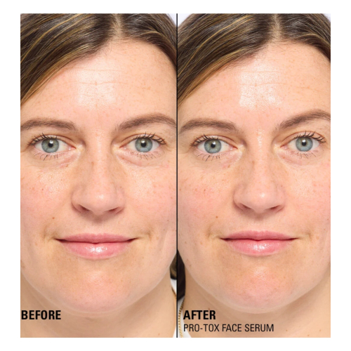 Revolution Pro - *Miracle Pro-Tox* - Sérum visage réparateur et comblant les rides