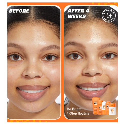 Revolution Skin - *Be Bright* - Sérum visage éclaircissant avec 3 % de vitamine C Brighten Up