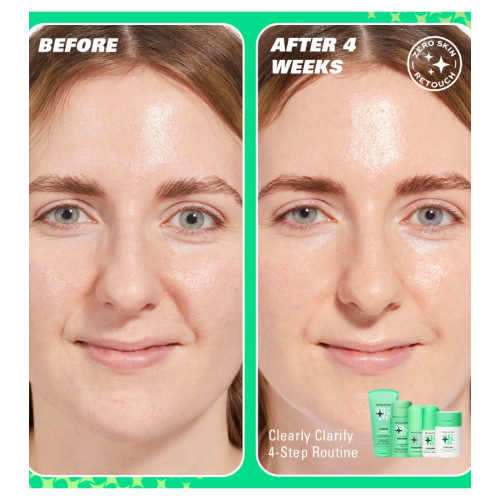 Revolution Skin - *Clearly Clarify* - Sérum visage clarifiant 5 % de niacinamide et 2 % d'acide salicylique Clear Canvas