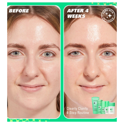 Revolution Skin - *Clearly Clarify* - Sérum visage clarifiant 10 % niacinamide Serum Supreme